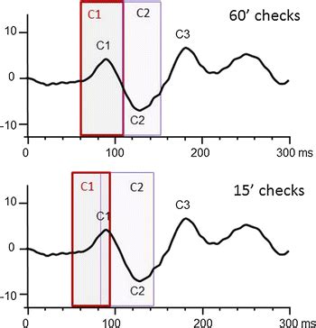 dominique versace|The changing shape of the ISCEV standard pattern onset VEP.